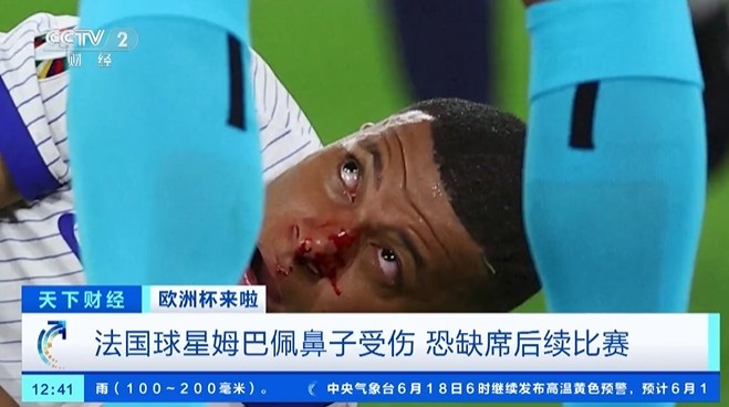 央视财经报道欧洲杯：法国球星姆巴佩鼻子受伤，恐缺席后续比赛